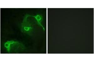 Immunofluorescence analysis of COS7 cells, using VAV2 (Ab-142) Antibody. (VAV2 抗体  (AA 108-157))