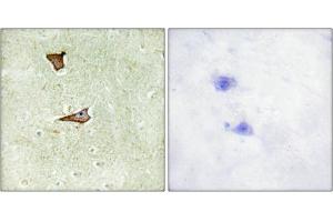 Immunohistochemical analysis of paraffin-embedded human brain tissue using IGF2R (Phospho-Ser2409) antibody (left)or the same antibody preincubated with blocking peptide (right). (IGF2R 抗体  (pSer2409))