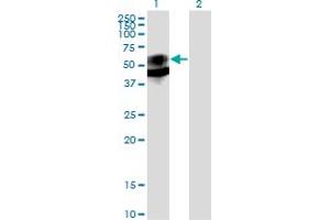 Western Blotting (WB) image for anti-Prosaposin (PSAP) (AA 18-524) antibody (ABIN562465)