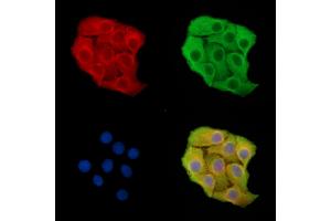 ABIN7095770 and ABIN7099832 staining Hela cells by IF/ICC. (RNF128 抗体)