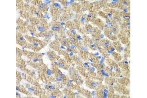 Immunohistochemistry of paraffin-embedded Mouse heart using FIBP Polyclonal Antibody at dilution of 1:100 (40x lens). (FIBP 抗体)
