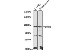 Western blot analysis of extracts of various cell lines, using STRN3 antibody (ABIN6129134, ABIN6148646, ABIN6148648 and ABIN6222490) at 1:1000 dilution. (STRN3 抗体  (AA 200-460))