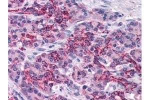 Human Pancreas: Formalin-Fixed, Paraffin-Embedded (FFPE) (XIAP 抗体  (AA 75-226))
