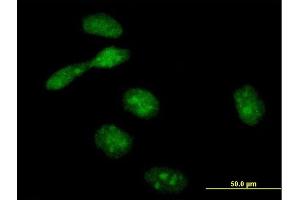 Immunofluorescence of purified MaxPab antibody to EME1 on HeLa cell. (Crossover junction endonuclease EME1 (EME1) (AA 1-583) 抗体)