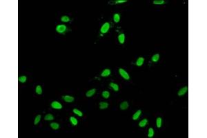 Immunofluorescent analysis of Hela cells using ABIN7139607 at dilution of 1:100 and Alexa Fluor 488-congugated AffiniPure Goat Anti-Rabbit IgG(H+L) (H2AFZ 抗体  (meLys7))