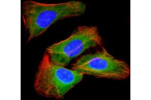 Immunofluorescent analysis of 4 % paraformaldehyde-fixed, 0. (RAB23 抗体)