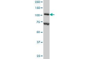 DPYD monoclonal antibody (M01), clone 7D4 Western Blot analysis of DPYD expression in HeLa .