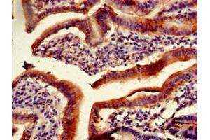 Immunohistochemistry of paraffin-embedded human duodenum tissue using ABIN7163465 at dilution of 1:100