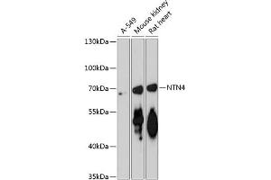 Western blot analysis of extracts of various cell lines, using NTN4 antibody (ABIN6128371, ABIN6144901, ABIN6144902 and ABIN6217888) at 1:3000 dilution. (Netrin 4 抗体  (AA 290-520))