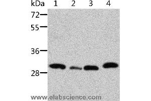 Western blot analysis of Mouse pancreas and spleen tissue, mouse heart tissue and 293T cell, using STRADB Polyclonal Antibody at dilution of 1:500 (STRADB 抗体)