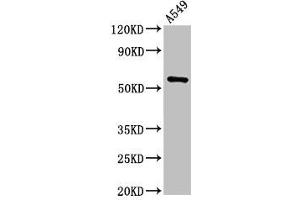 Western Blot Positive WB detected in: A549 whole cell lysate All lanes: TRIM21 antibody at 2 μg/mL Secondary Goat polyclonal to rabbit IgG at 1/50000 dilution Predicted band size: 55, 46 kDa Observed band size: 55 kDa (TRIM21 抗体  (AA 1-475))