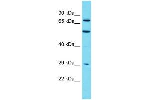 Host: Rabbit Target Name: MTMR7 Sample Type: HT1080 Whole Cell lysates Antibody Dilution: 1.