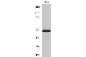 Western Blotting (WB) image for anti-Caspase 9, Apoptosis-Related Cysteine Peptidase (CASP9) (pThr125) antibody (ABIN3182484) (Caspase 9 抗体  (pThr125))