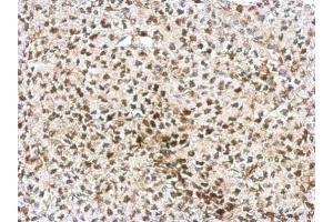 IHC-P Image Immunohistochemical analysis of paraffin-embedded D54 xenograft, using AF9, antibody at 1:750 dilution. (AF9 抗体  (Center))