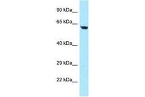 anti-Transforming Growth Factor beta Regulator 4 (TBRG4) (AA 43-92) antibody