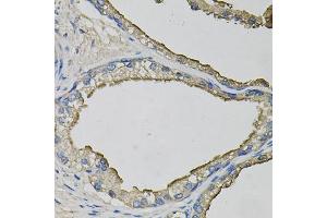 Immunohistochemistry of paraffin-embedded human prostate using LCN1 antibody. (Lipocalin 1 抗体)