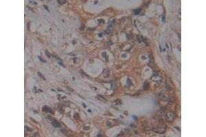 Immunohistochemistry (IHC) image for anti-Tumor Necrosis Factor Receptor Superfamily, Member 21 (TNFRSF21) (AA 420-568) antibody (ABIN1176213)