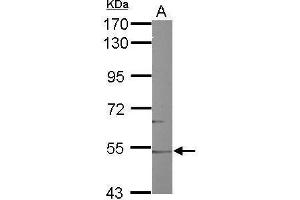 Western Blotting (WB) image for anti-Cytochrome P450, Family 46, Subfamily A, Polypeptide 1 (CYP46A1) (Center) antibody (ABIN2856057)