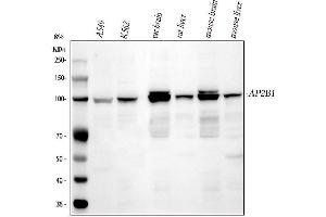Western blot analysis of AP2B1 using anti-AP2B1 antibody (ABIN4886461).