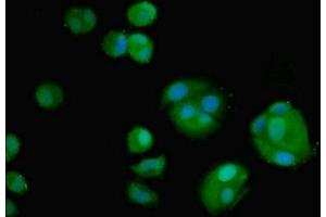 Immunofluorescent analysis of MCF-7 cells using ABIN7160302 at dilution of 1:100 and Alexa Fluor 488-congugated AffiniPure Goat Anti-Rabbit IgG(H+L) (AMH 抗体  (AA 26-560))