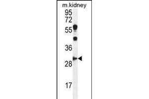 CCNG1 Antibody (C-term) (ABIN655159 and ABIN2844777) western blot analysis in mouse kidney tissue lysates (35 μg/lane). (Cyclin G1 抗体  (C-Term))