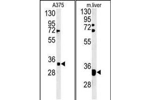 (LEFT)Western blot analysis of FYTD1 Antibody (N-term) (ABIN651416 and ABIN2840226) in  cell line lysates (35 μg/lane). (FYTTD1 抗体  (N-Term))