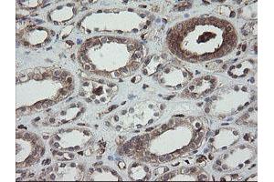 Image no. 8 for anti-Protein Disulfide Isomerase Family A, Member 3 (PDIA3) antibody (ABIN1498107)