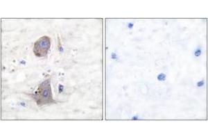 Immunohistochemistry analysis of paraffin-embedded human brain tissue, using GLUT1 Antibody. (GLUT1 抗体  (AA 441-490))
