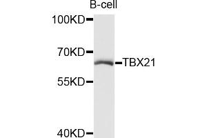 Western blot analysis of extracts of B-cell cells, using TBX21 antibody (ABIN5972689) at 1/1000 dilution. (T-Bet 抗体)