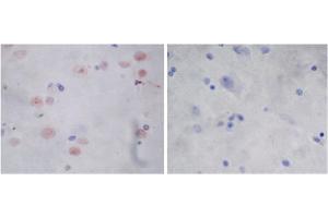 Immunohistochemistry analysis of human brain tissue slide (Paraffin embedded) using Rabbit Anti-Parkin Polyclonal Antibody (left, ABIN398785) and Purified Rabbit IgG (whole molecule) Control (right, ABIN398653) (Parkin 抗体  (AA 300-350))