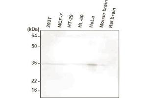 Western blot analysis. (HTRA2 抗体  (AA 134-458))