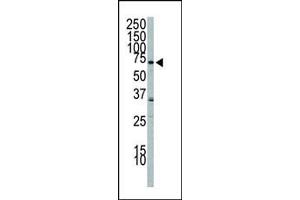 Western Blotting (WB) image for anti-Phosphoinositide 3 Kinase, p85 beta (PI3K p85b) (AA 268-298), (C-Term) antibody (ABIN392575)