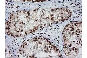 Image no. 7 for anti-Nonhomologous End-Joining Factor 1 (NHEJ1) antibody (ABIN1499728)