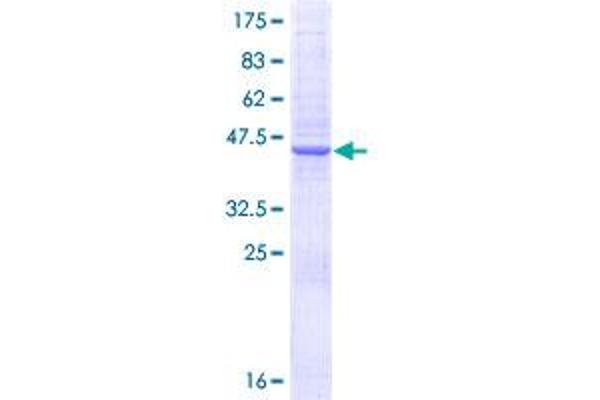 N6AMT1 Protein (AA 1-186) (GST tag)