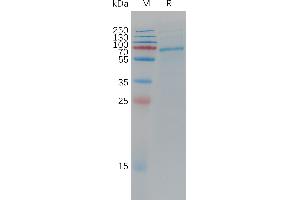 ADAM Metallopeptidase Domain 9 (ADAM9) (AA 29-698) protein (His tag)