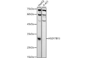 Western blot analysis of extracts of various cell lines, using HSD17B13 antibody (ABIN7267809) at 1:1000 dilution. (HSD17B13 抗体)