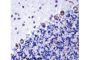 Immunohistochemistry (IHC) image for anti-Colony Stimulating Factor 1 Receptor (CSF1R) (AA 895-923) antibody (ABIN3028575)
