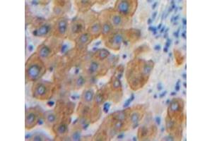 Used in DAB staining on fromalin fixed paraffin-embedded Liver tissue (SHB 抗体  (AA 248-484))