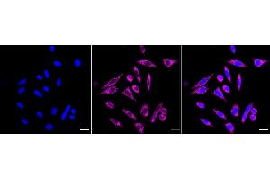 Immunocytochemical staining of HepG2 cells with HDHD5 antibody (ABIN7798836), 1:1,000). (Recombinant Haloacid Dehalogenase-Like Hydrolase Domain-Containing 5 (HDHD5) 抗体)
