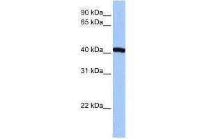 FTSJ1 antibody used at 1 ug/ml to detect target protein. (FTSJ1 抗体)