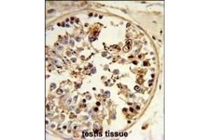 Formalin-fixed and paraffin-embedded human testis tissue reacted with ASPSCR1 Antibody (C-term), which was peroxidase-conjugated to the secondary antibody, followed by DAB staining.