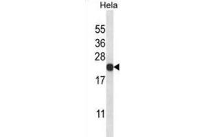 Western Blotting (WB) image for anti-Proteasome (Prosome, Macropain) Subunit, beta Type, 5 (PSMB5) antibody (ABIN2998050) (PSMB5 抗体)