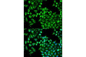 Immunofluorescence analysis of A549 cells using ABAT antibody. (ABAT 抗体)