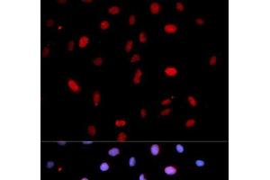 Immunofluorescence analysis of U2OS cells using Phospho-MAP2K6(S207)/MAP2K3(S189) Polyclonal Antibody (MAP2K6 抗体  (pSer189, pSer207))