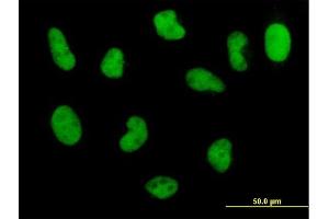 Immunofluorescence of monoclonal antibody to POLD3 on HeLa cell. (POLD3 抗体  (AA 357-466))