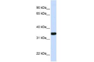 GAPDH antibody used at 1 ug/ml to detect target protein. (GAPDH 抗体  (N-Term))