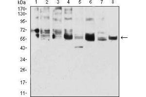 Western blot analysis using CK5 mouse mAb against A431 (1), 3T3-L1 (2), COS7 (3), MCF-7 (4), SK-Br-3 (5), Hela (6), Lncap (7), and HepG2 (8) cell lysate. (Cytokeratin 5 抗体  (AA 258-357))