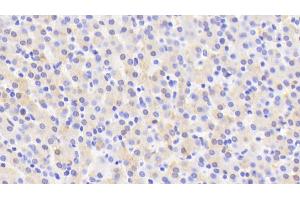 Detection of CYP2D6 in Human Liver Tissue using Polyclonal Antibody to Cytochrome P450 2D6 (CYP2D6) (CYP2D6 抗体  (AA 236-472))