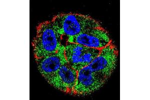Immunofluorescence (IF) image for anti-Tumor Protein P53 (TP53) (AA 1-30) antibody (ABIN390201)