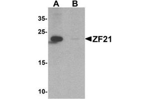 Western blot analysis of ZF21 in 3T3 cell tissue lysate with ZF21 Antibody  at 1 µg/ml in (A) the absence and (B) the presence of blocking peptide.